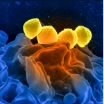 zakwas-bolotowa-wirusy-bakterie_20.png